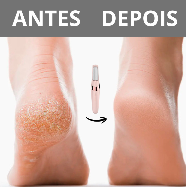 Lima elétrica para pés