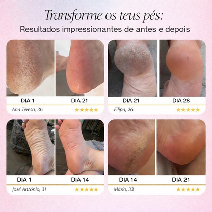 Lima elétrica para pés